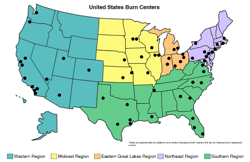 Burn Injuries Attorney in CT Buckley Wynne & Parese
